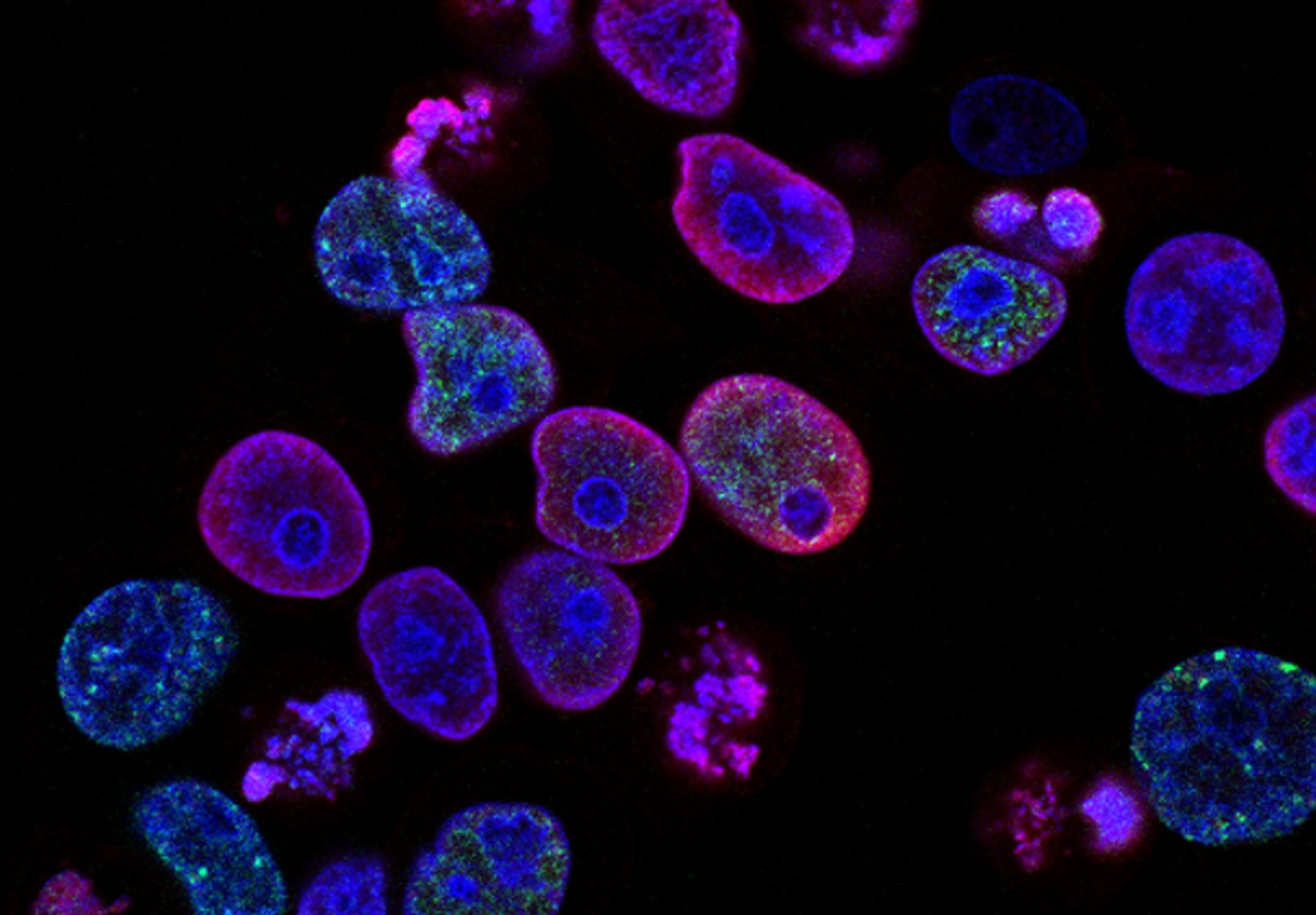 national-cancer-institute-L7en7Lb-Ovc-unsplash